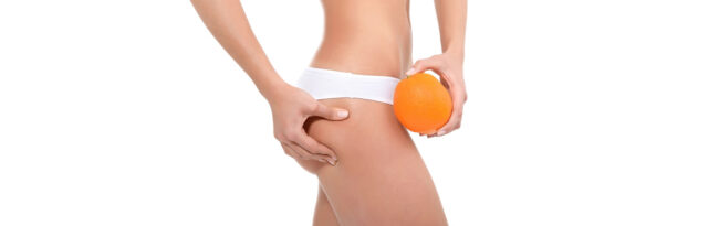 cellulite
