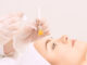 Trattamento peeling chimico pulizia viso