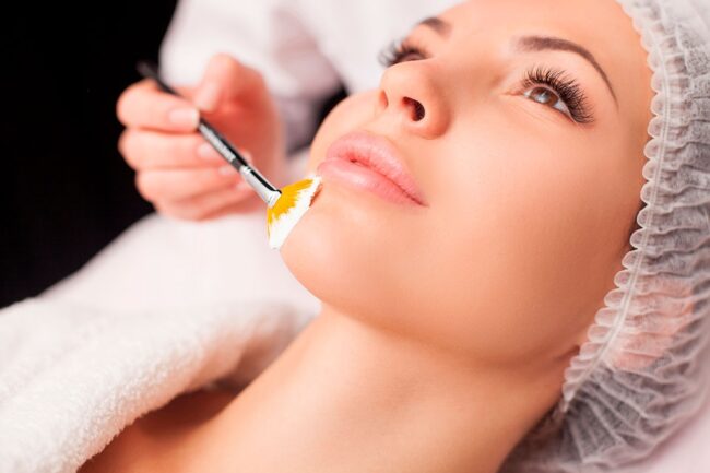 Peeling Chimico - tutto quello che devi sapere