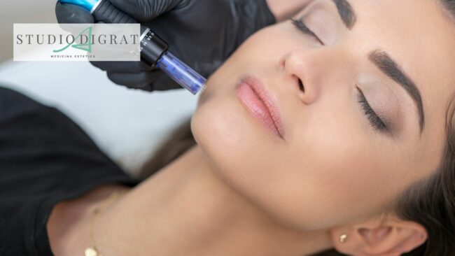 Needling a Milano Needling a Milano