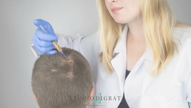 Trattamenti per la cura dell’alopecia